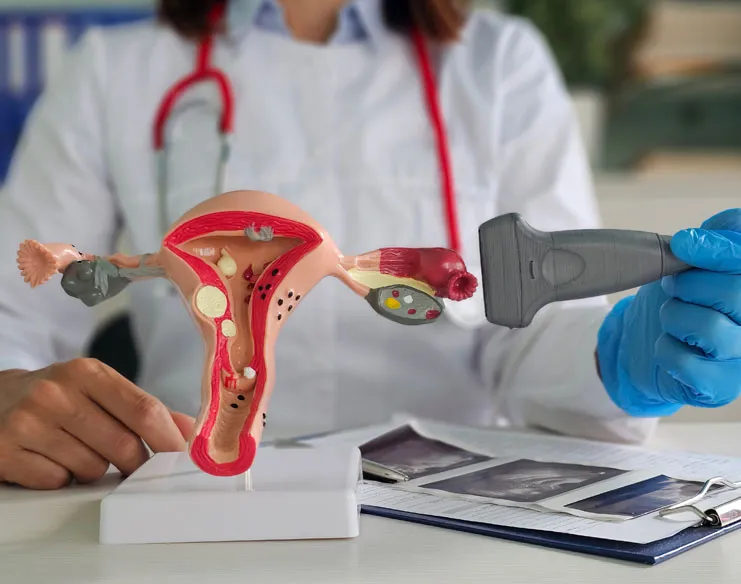 How Can Ovarian Cysts Negatively Affect Your Fertility?