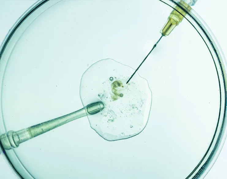 Understanding How Many IVF Cycles Are Needed